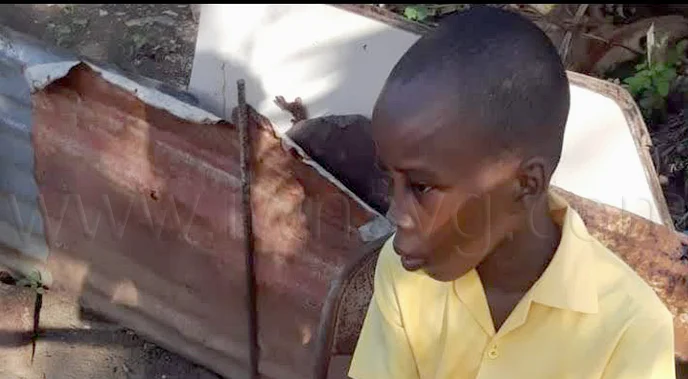 Muere quemado de 16 años horas antes de viaje a EE.UU. por cuidados avanzados