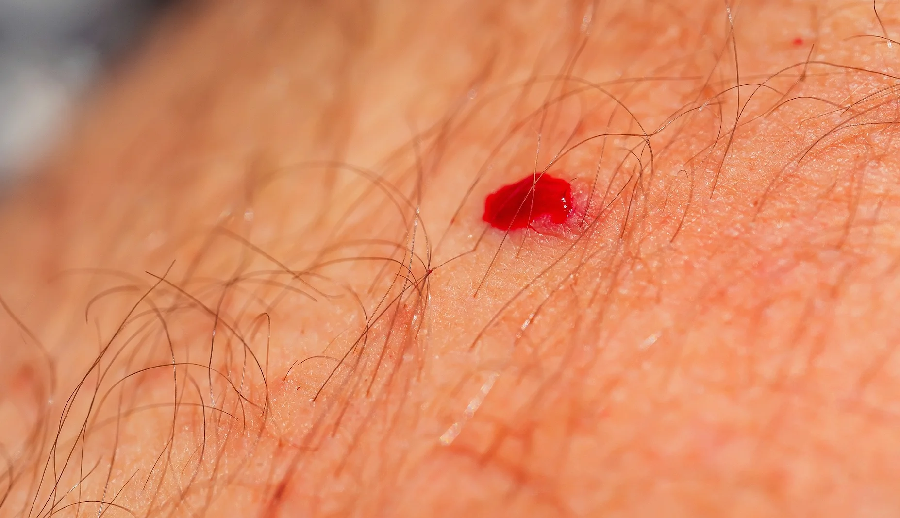 Mosquitos en Mata Atlántica prefieren sangre humana por deforestación