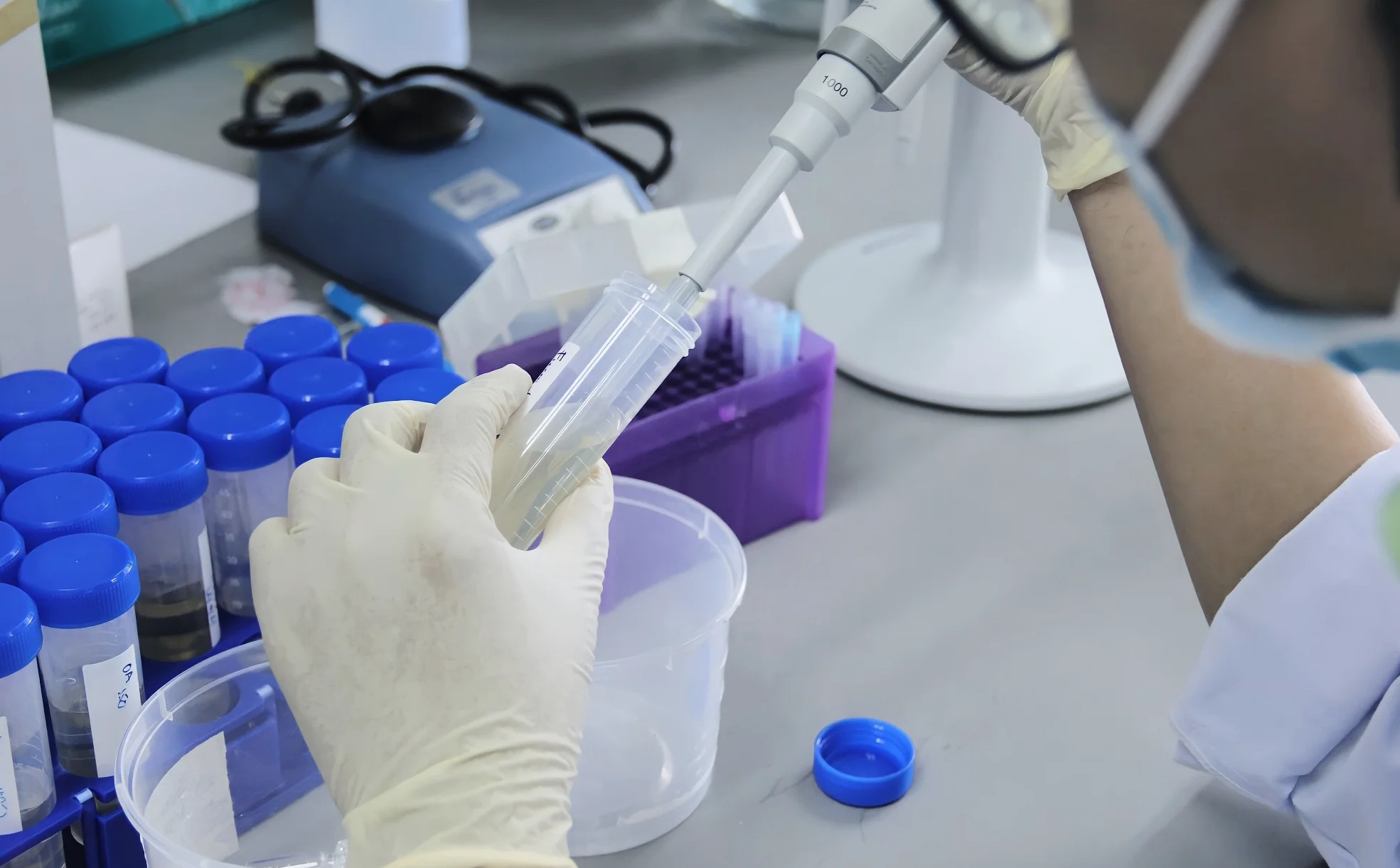 機械学習で自己集合ナノ粒子の設計を最適化し、線維化組織への薬物送達を向上