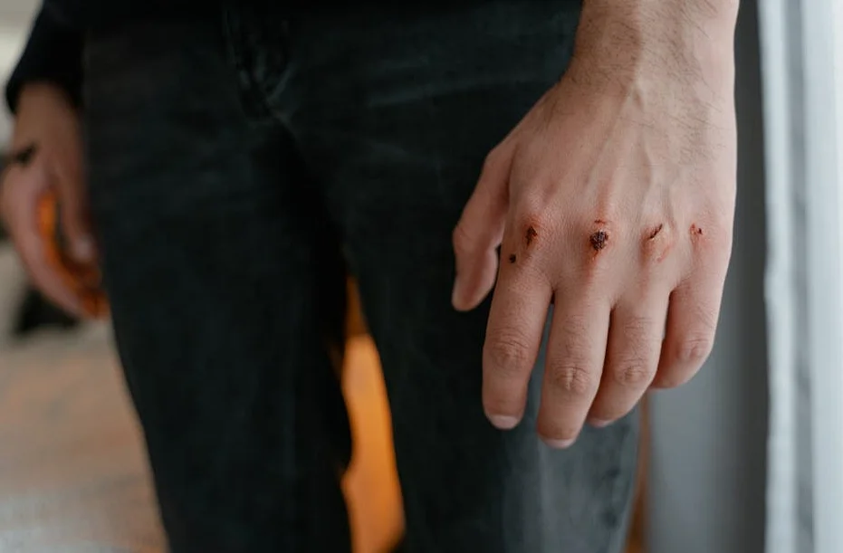 Rusia mata a 4 y deja 16 heridos en el este de Ucrania