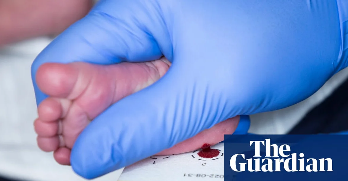 스코틀랜드, 영국 최초로 신생아 척수근위축증 검사 시행