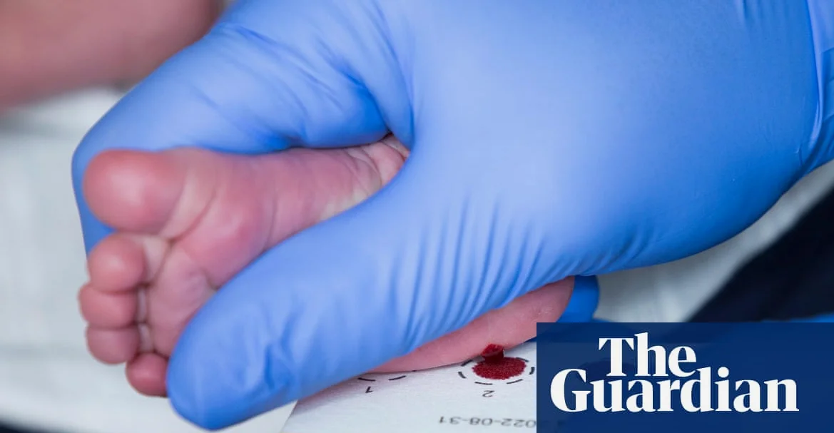 Scotland becomes first part of UK to screen newborns for spinal muscular atrophy