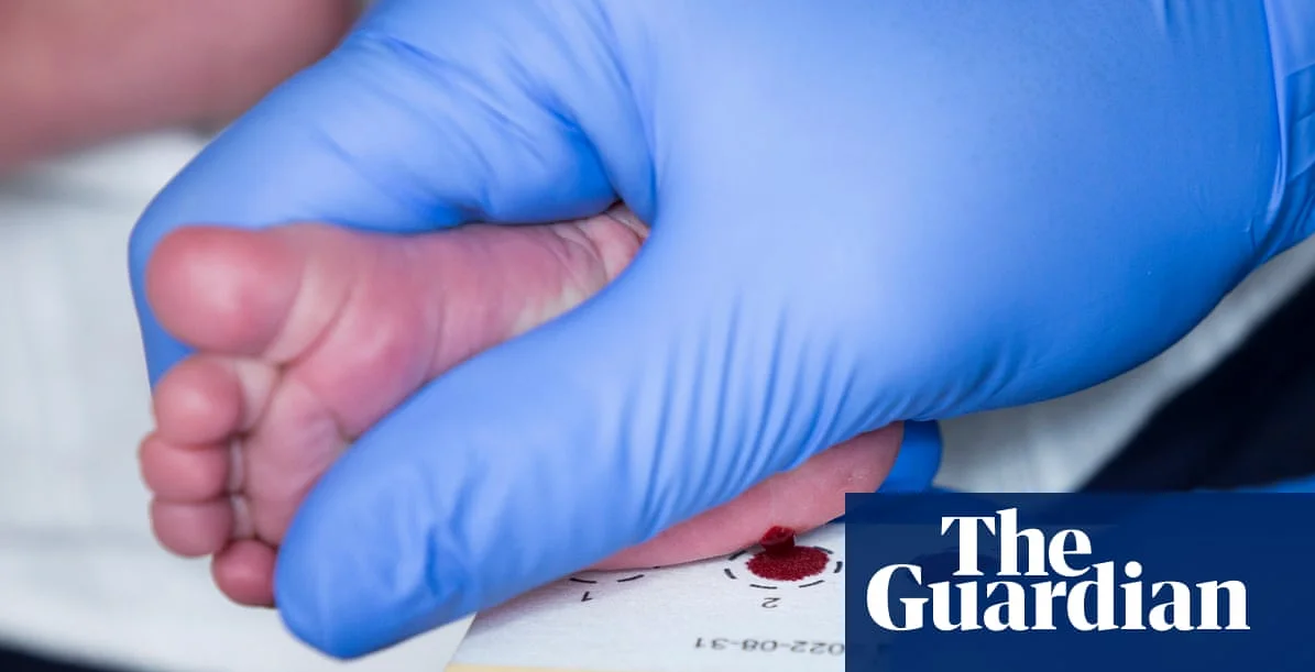 스코틀랜드, 영국 최초로 신생아 척수근위축증 검사 도입