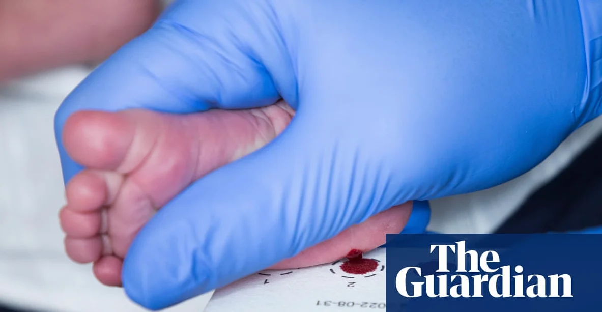 스코틀랜드, 영국 최초로 신생아 SMA 검사 도입