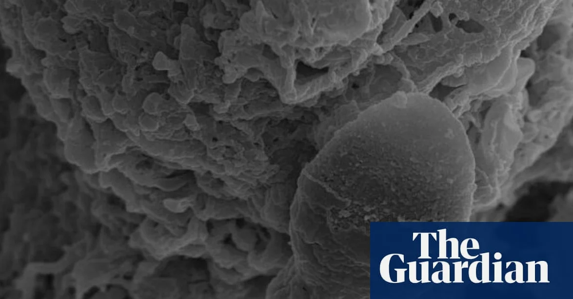 Australian Study Suggests Sperm Get Lost in Space Due to Microgravity