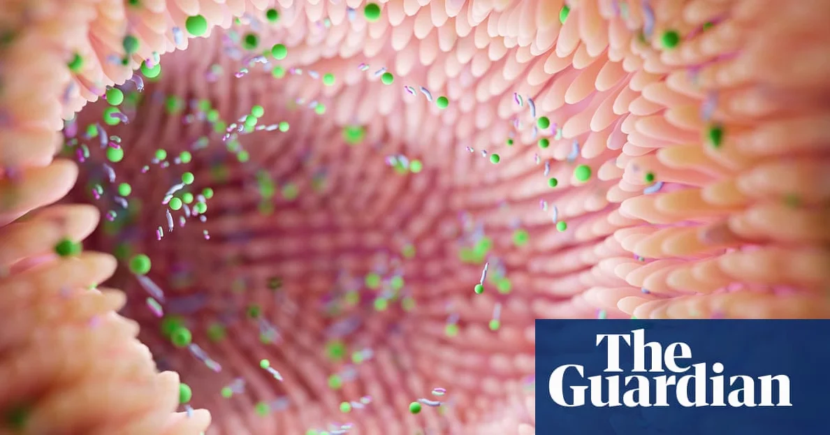 腸内細菌の特徴でパーキンソン病のリスクが判明