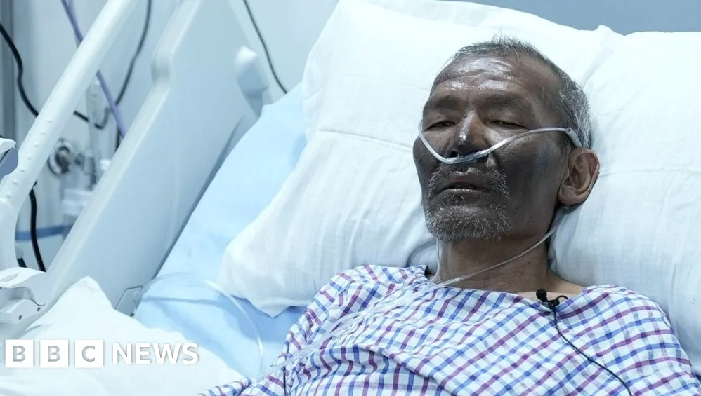 Everest Guide’s Miraculous Survival Sparks Questions