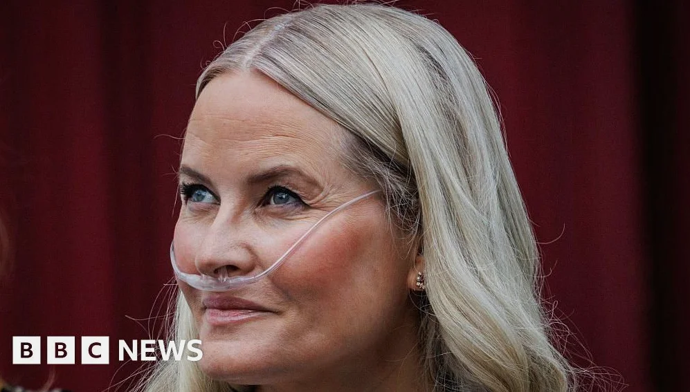 Norway’s Crown Princess Undergoes Lung Transplant