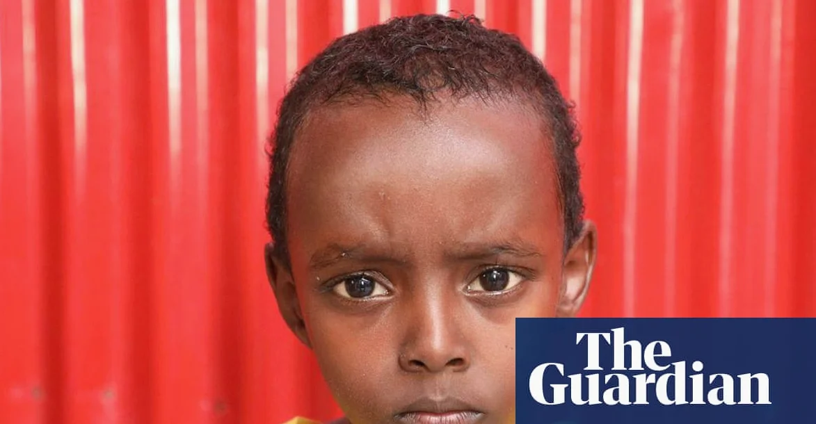 Seven-year-old Abdiqadir was hit in a US airstrike. Without a $750 operation, he may lose his ability to walk
