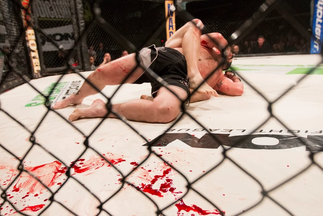 Conor McGregor Suffers Early Injury in UFC 329 Loss to Max Holloway
