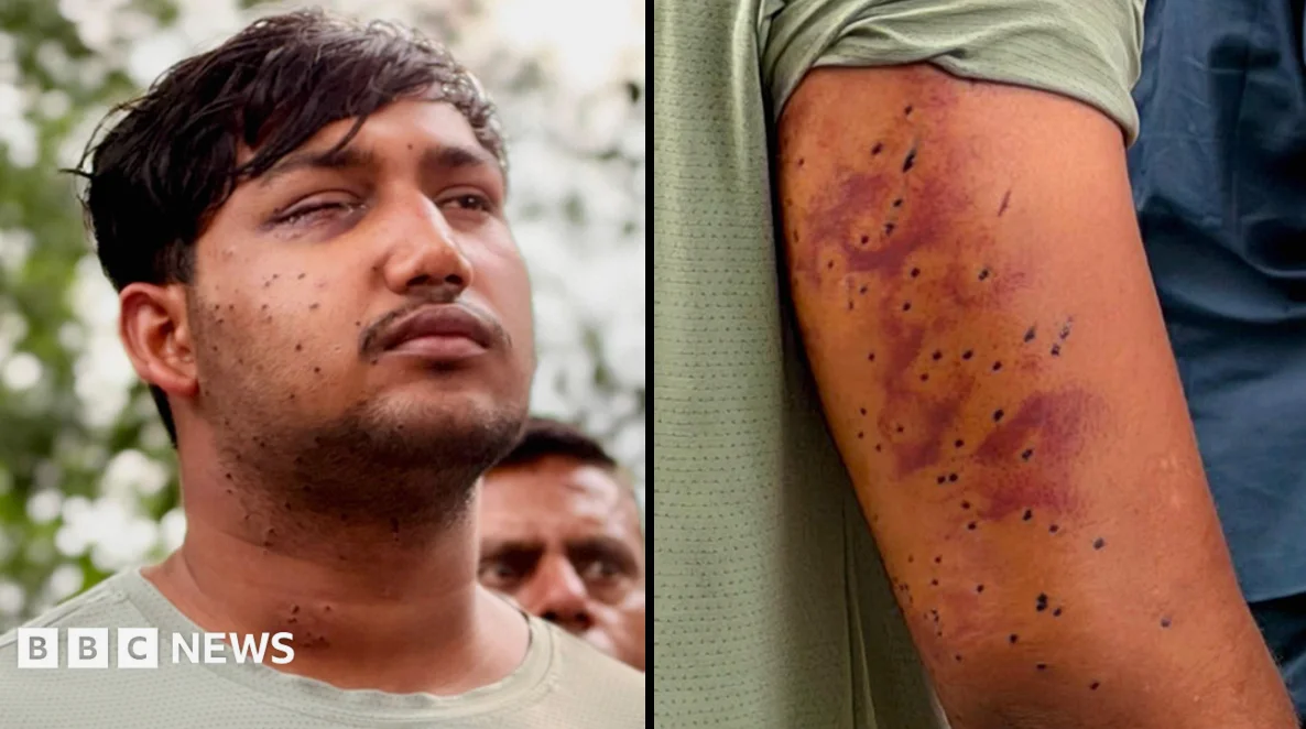 India’s ‘Cockroach’ Protesters Have Wounds from Pellet-Gun Fire, Experts Say